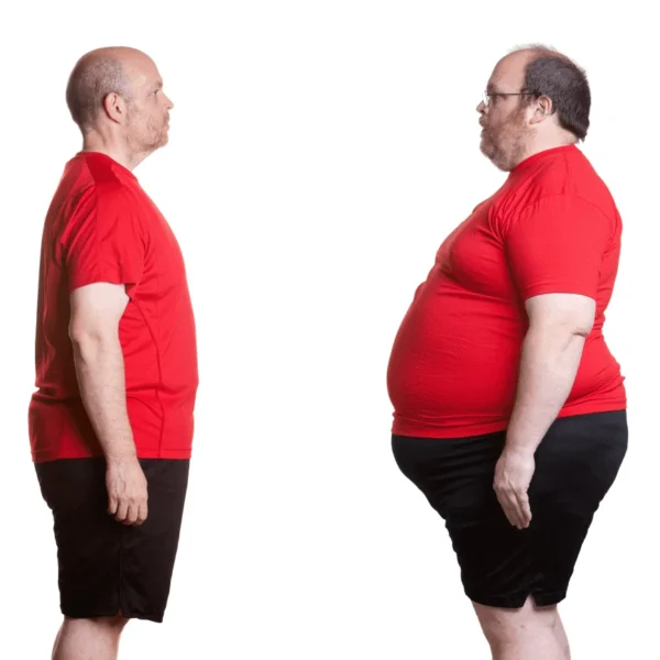 obesity-diabetes